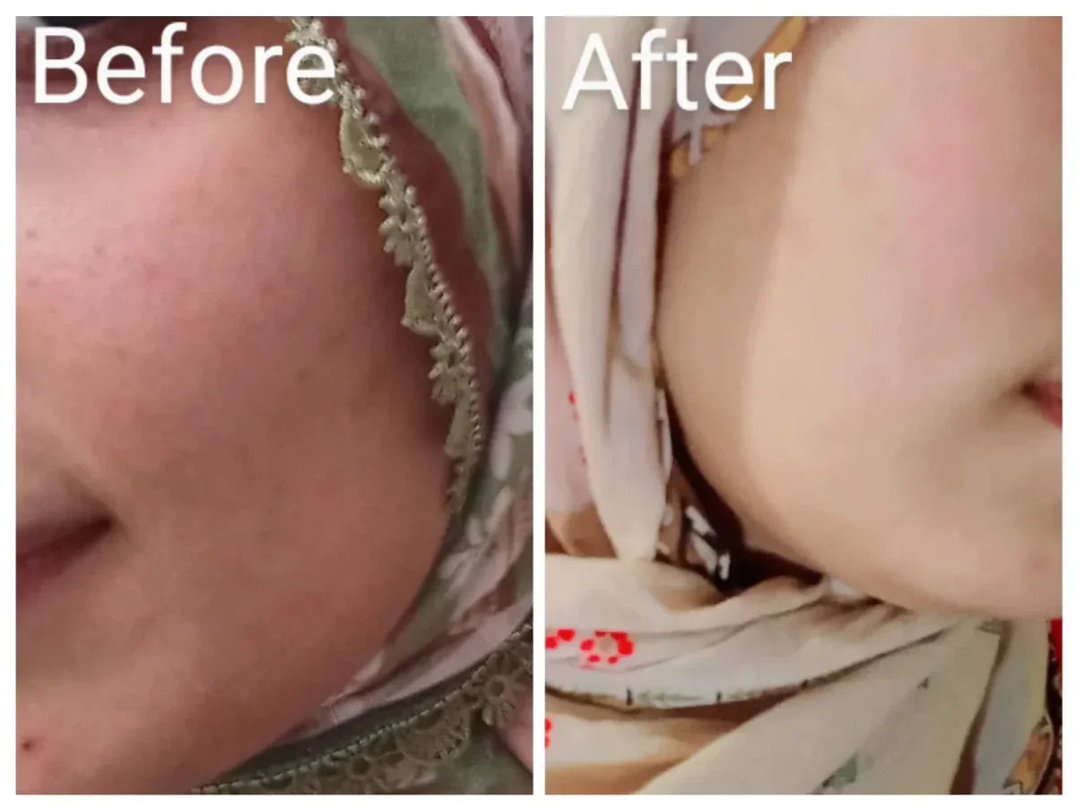 Korean Miracle Brightening Serum – Glowing Skin & Even Complexion | For All Skin Types - Darnova by Darakhshan