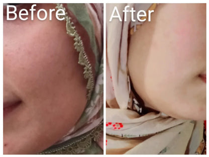 Korean Miracle Brightening Serum – Glowing Skin & Even Complexion | For All Skin Types - Darnova by Darakhshan